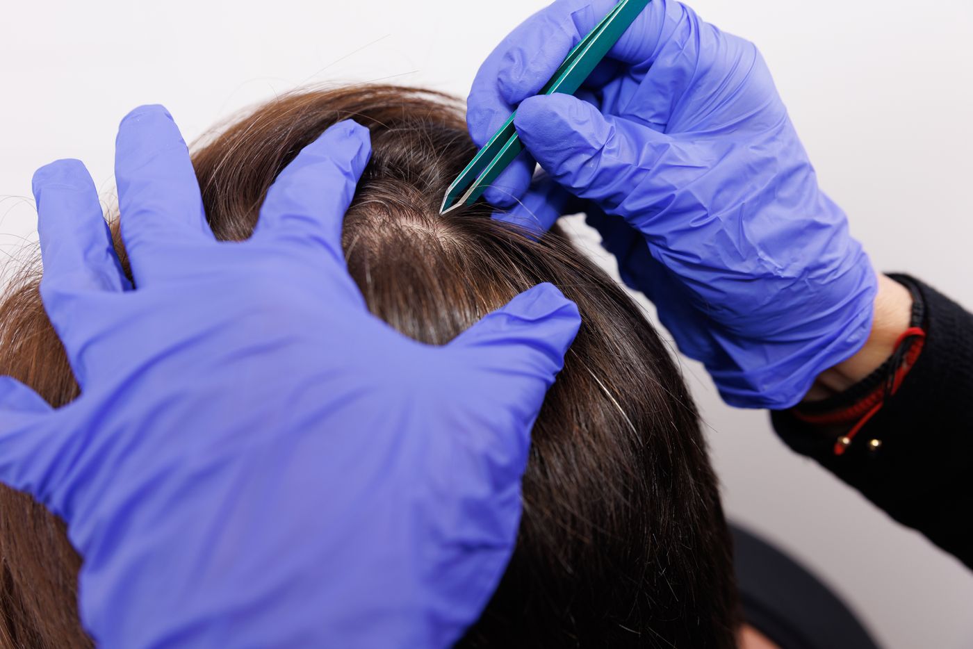 Toma de la muestra de cabello